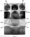 Fig. 09 - Peelable package