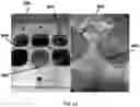 Fig. 12 - Peelable package