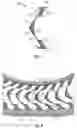 Fig. 05 - Reinforced rubber spoke for a tire