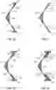 Fig. 09 - Reinforced rubber spoke for a tire