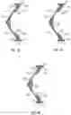 Fig. 10 - Reinforced rubber spoke for a tire