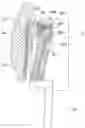 Fig. 01 - HEADREST