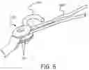 Fig. 10 - Hand-driven ratchet strap assist device