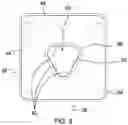Fig. 04 - PORTABLE COMMODE ASSEMBLY
