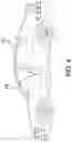 Fig. 09 - PORTABLE COMMODE ASSEMBLY