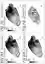 Fig. 15 - Analysis method and apparatus of optimizing joint location of automotive body