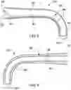 Fig. 04 - Bicycle handlebar cushioning system