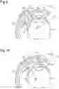 Fig. 06 - Bicycle hub assembly and bicycle control system
