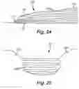 Fig. 26 - Method and system for a towed vessel suitable for transporting liquids