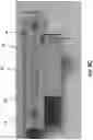 Fig. 10 - Packaging apparatus for film inflation and method thereof