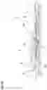 Fig. 15 - Liftable carrying apparatus