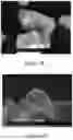 Fig. 06 - Process, device and system for treatment of water