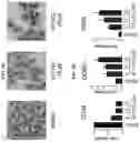 Fig. 08 - PRC1 inhibitors and methods of treatment therewith