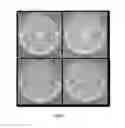 Fig. 07 - CHIMERIC GENE FOR HETEROLOGOUS EXPRESSION WHICH ENCODES FOR PEPTIDES WITH ANTIMICROBIAL ACTIVITY