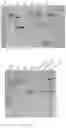 Fig. 03 - PROCESS OF CLONING AND FURTHER PURIFICATION TO MAKE A RECOMBINANT INTRAVENOUS IMMUNOGLOBULIN