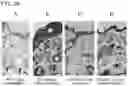 Fig. 32 - ACTIVITY MODULATOR, MEDICINAL AGENT COMPRISING SAME, USE OF CD300A GENE-DEFICIENT MOUSE, AND ANTI-CD300A ANTIBODY