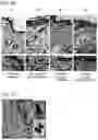 Fig. 34 - ACTIVITY MODULATOR, MEDICINAL AGENT COMPRISING SAME, USE OF CD300A GENE-DEFICIENT MOUSE, AND ANTI-CD300A ANTIBODY