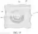 Fig. 15 - Thermal and cold spray plastic coating covering vehicle fasteners inside fuel tank for lightning strike and other electromagnetic protection