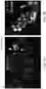 Fig. 02 - Cell culture media and method for culturing breast cancer cells