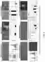 Fig. 06 - Multi donor stem cell compositions and methods of making same