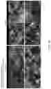 Fig. 11 - Multi donor stem cell compositions and methods of making same
