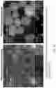 Fig. 16 - Multi donor stem cell compositions and methods of making same
