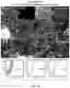 Fig. 17 - Multi donor stem cell compositions and methods of making same