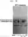 Fig. 08 - Transaminases and method, for deaminating amino compound, using same