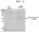 Fig. 09 - Transaminases and method, for deaminating amino compound, using same