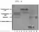 Fig. 10 - Transaminases and method, for deaminating amino compound, using same