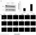 Fig. 05 - Methods and pharmaceutical compositions for the treatment of cystic fibrosis