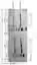Fig. 02 - P-ethoxy nucleic acids for STAT3 inhibition