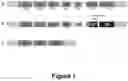 Fig. 02 - ANTISENSE POLYNUCLEOTIDES TO INDUCE EXON SKIPPING AND METHOD OF TREATING DYSTROPHIES