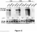 Fig. 13 - ANTISENSE POLYNUCLEOTIDES TO INDUCE EXON SKIPPING AND METHOD OF TREATING DYSTROPHIES