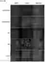Fig. 28 - Compositions and methods for the treatment of hypercholesterolemia