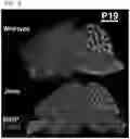 Fig. 04 - METHODS AND COMPOSITIONS FOR ENHANCING FUNCTIONAL MYELIN PRODUCTION