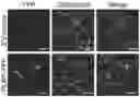 Fig. 01 - Enhanced lipid biosynthesis via engineered plastid lipases