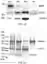 Fig. 03 - Enhanced lipid biosynthesis via engineered plastid lipases