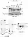 Fig. 04 - Enhanced lipid biosynthesis via engineered plastid lipases