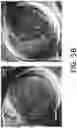 Fig. 20 - Enhanced lipid biosynthesis via engineered plastid lipases