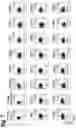 Fig. 11 - T cell receptors that bind to NY-ESO-1 and methods of use thereof