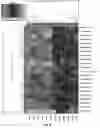 Fig. 06 - COLORECTAL CANCER SCREENING METHOD AND DEVICE