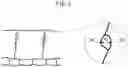 Fig. 04 - NITRIDED PART AND METHOD OF PRODUCTION OF SAME