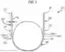 Fig. 02 - Knitting needle with swivel joint