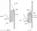Fig. 11 - Rotating component of a laundry appliance with a helical seam