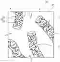 Fig. 01 - Method for producing composite material