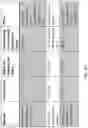Fig. 11 - Method and apparatus for producing a fibre web