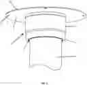 Fig. 06 - Method of retrofitting a bathtub drainage pipe