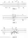 Fig. 05 - TRANSPARENT SHEETS WITH CONNECTION MEMBERS