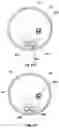 Fig. 14 - Method and assembly for downhole deployment of well equipment